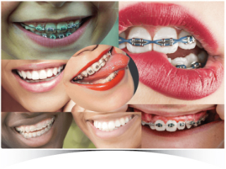 Tingrinners Club Ja - Dental Care Programmes